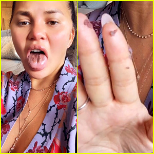 Chrissy Teigen dice que ella'Tongue Is Falling Off' from Eating 'So Much' Sour Candy