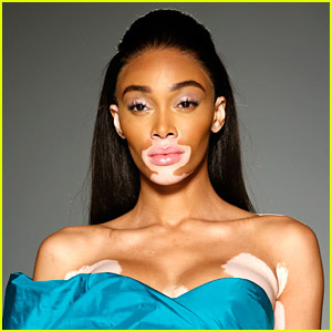 Winnie Harlow bocsánatot kért egy nőtől, aki azzal vádolja, hogy „aljas lány”, majd azt mondja, hogy hazudik a befolyásért | Winnie Harlow